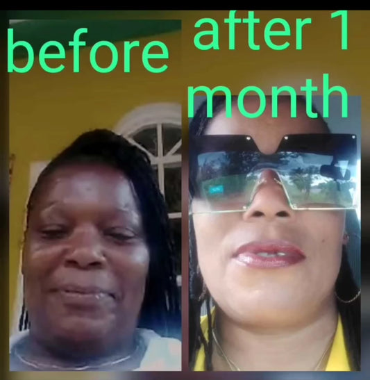 Face Cream